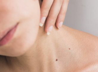 Revolutionary Discovery in Skin Cancer Treatment: The End of Metastatic Melanoma?