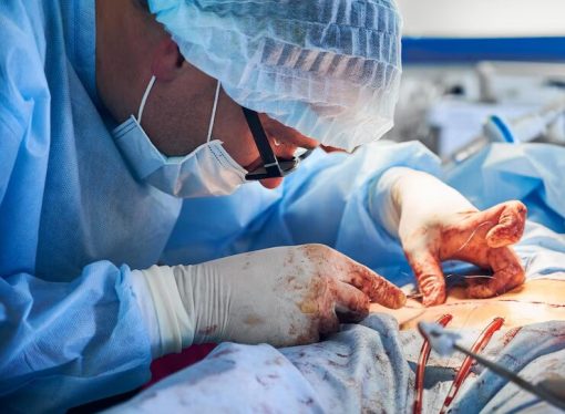 Raising Awareness and Hope: How Overhauling the Organ Transplant System Could Save Lives