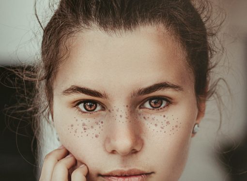 The Ultimate Guide to Treating Acne-Prone Skin: Best Products and Tips