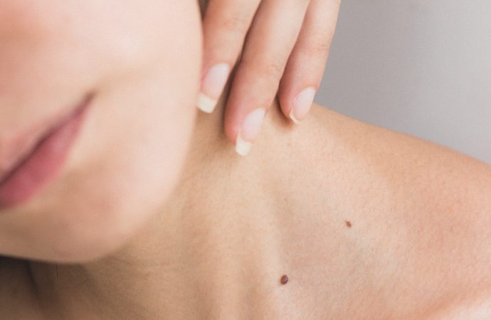 Why Men Must Be More Vigilant Against Melanoma