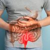 Colon Cancer on the Rise in Young People