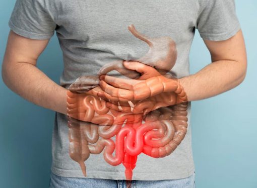 Colon Cancer on the Rise in Young People