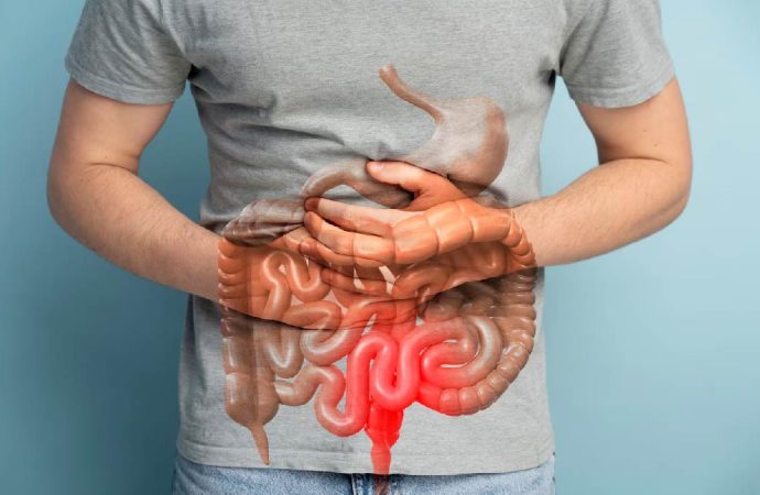 Colon Cancer on the Rise in Young People
