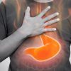 Managing GERD: Tips for Acid Reflux and Heartburn Relief