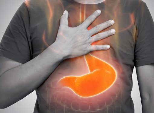 Managing GERD: Tips for Acid Reflux and Heartburn Relief