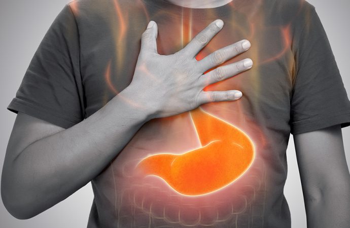 Managing GERD: Tips for Acid Reflux and Heartburn Relief