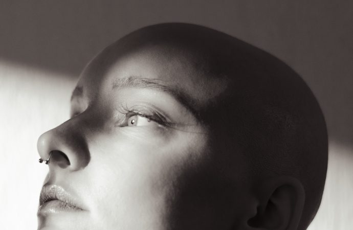 The Science Behind Hair-Loss Treatments