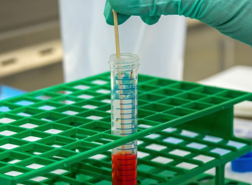 Rapid Cancer Blood Tests: A New Era in Diagnosis or a Cause for Concern?