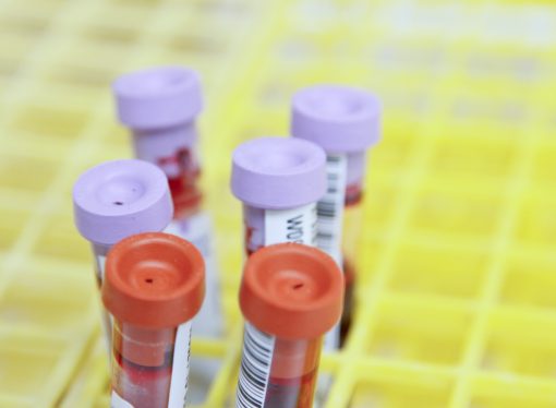 Rapid Cancer Blood Tests: A Game-Changer or Risky Business?