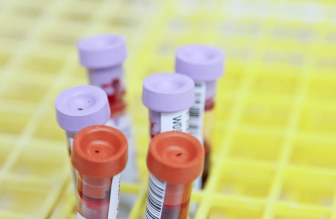 Rapid Cancer Blood Tests: A Game-Changer or Risky Business?