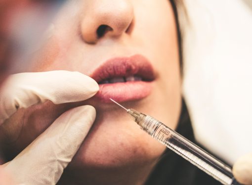 The Dos and Don’ts of Getting Lip Fillers: A Comprehensive Guide