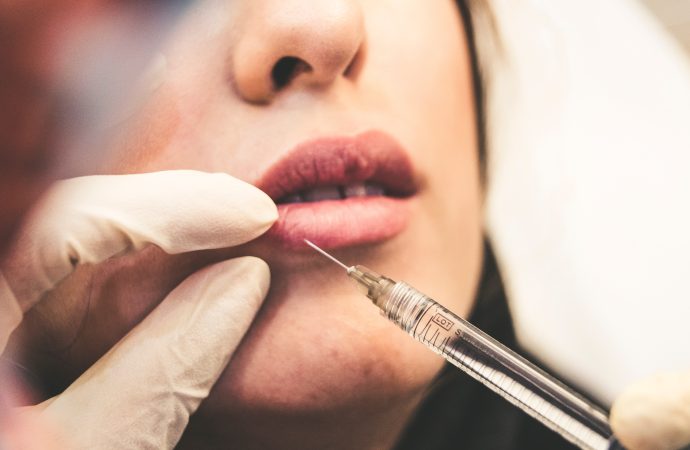 The Dos and Don’ts of Getting Lip Fillers: A Comprehensive Guide