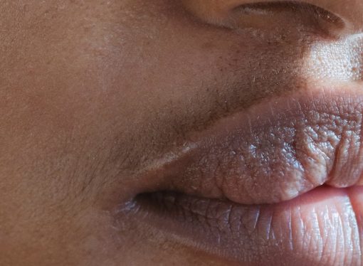 From Diet to Skincare: Identifying the Culprits Behind Your Stubborn Blackheads