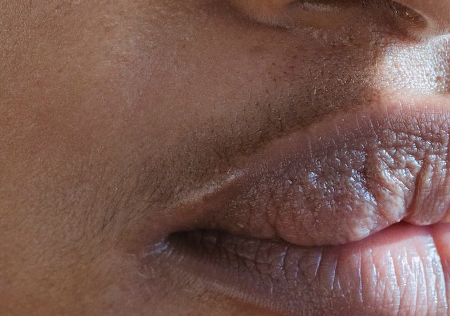 From Diet to Skincare: Identifying the Culprits Behind Your Stubborn Blackheads