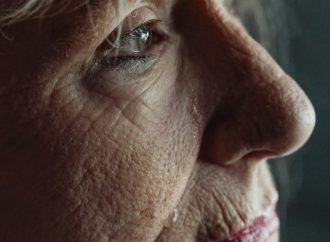 Debunking the Myth: Does Oily Skin Really Age Better?