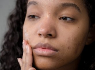 Breaking Down the Biggest Skincare Mistakes That Cause Acne