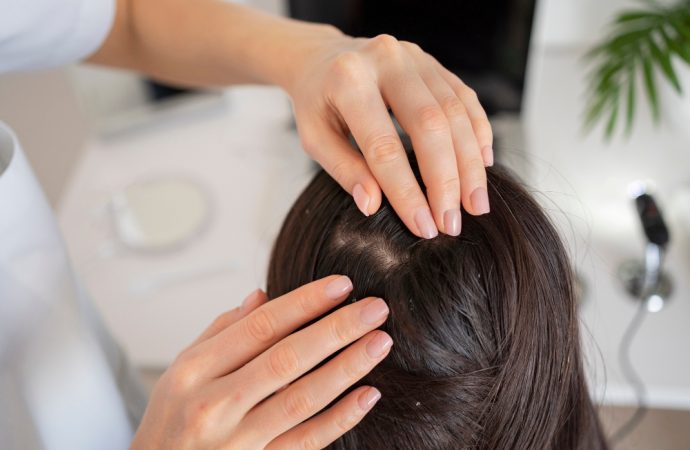 Dry Scalp Remedies: Tried and Tested Solutions Recommended by Dermatologists