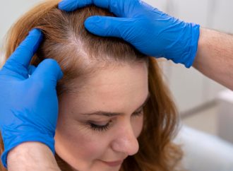 How to Soothe and Treat your Sensitive Scalp: Expert Advice from Dermatologists