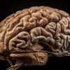 Unlocking Communication: The Evolution of Brain-Computer Interfaces for ALS and Locked-In Syndrome