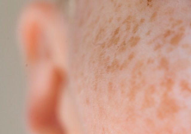 Ear Infections Causes, Symptoms, and Effective Treatments