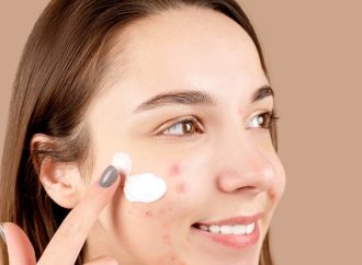 Clear Skin Secrets: 14 Effective Home Remedies for Acne