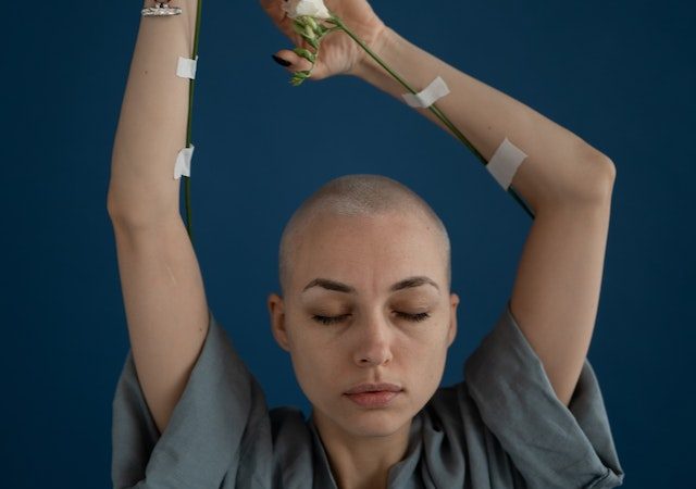 Unraveling Hair Fall and Cancer Myths What You Need to Know