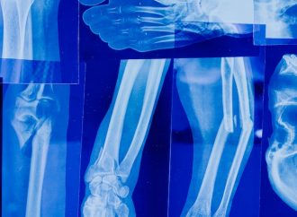 The Revolutionary Role of X Rays in Medical Diagnosis