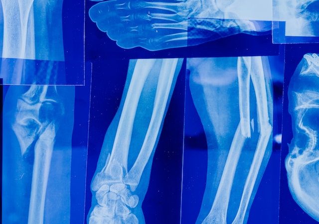 The Revolutionary Role of X Rays in Medical Diagnosis