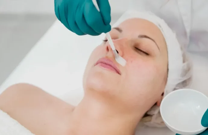 Revitalize Your Skin: A Comprehensive Guide to PCA Skin Peels by Dr. Harold Lancer