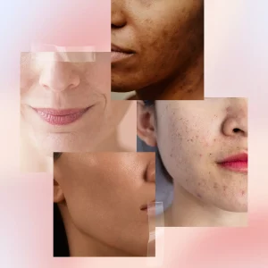 Unique Skin