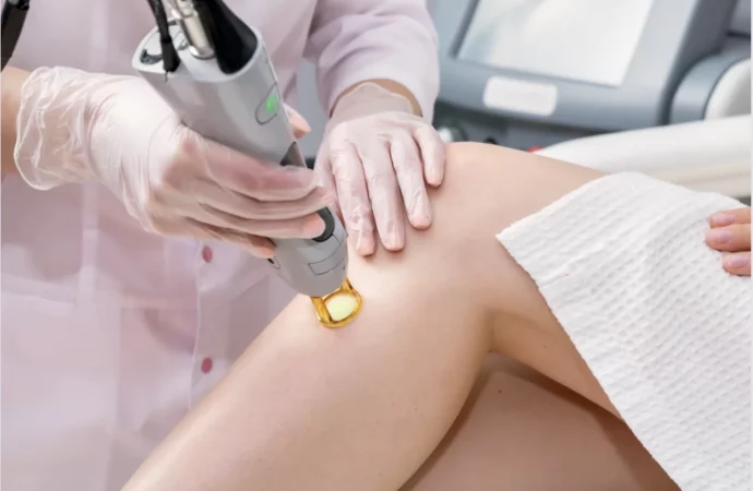 Mastering Laser Hair Removal Safety: A Guide by Dr. Shereene Idriss
