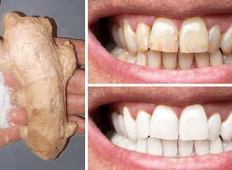 Dr. Andrew Weil’s Natural Teeth Whitening: 5 Easy Ways