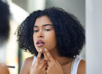 Clearer Skin Awaits: Avoid Acne Don’ts with Rosemary Gladstar’s Tips