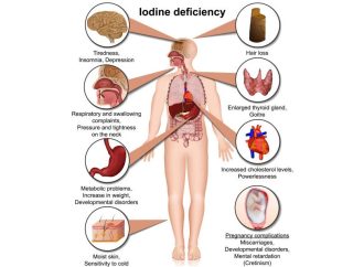 Iodine Deficiency: Causes and Consequences – A Vital Nutritional Concern