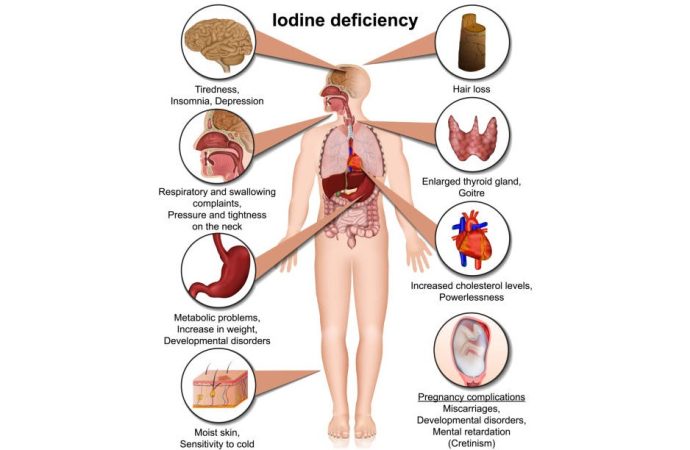 Iodine Deficiency: Causes and Consequences – A Vital Nutritional Concern