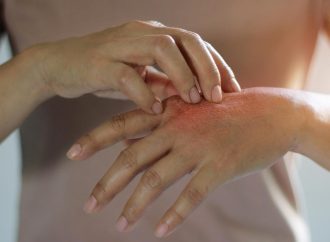 Diagnosing and Treating Skin Diseases: What You Need to Know