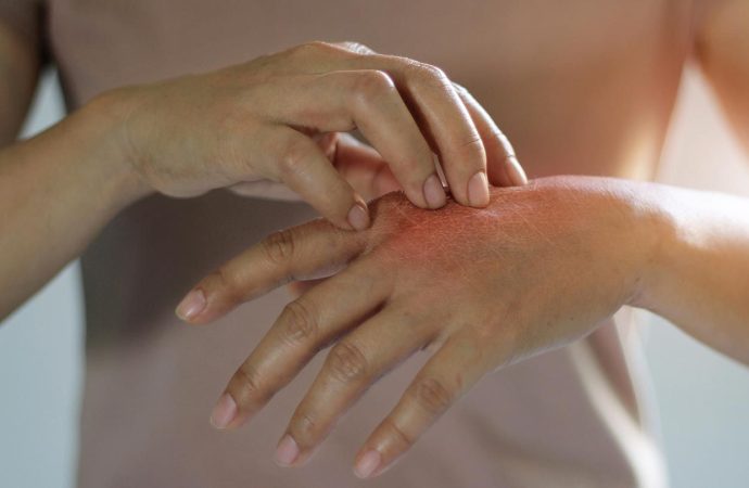 Diagnosing and Treating Skin Diseases: What You Need to Know