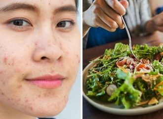 Diet for Radiance: 8 Dos and Don’ts to Keep Acne at Bay