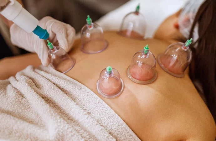 Revitalize Your Health: Dr. Mehmet Oz Explores the Top 5 Health Benefits of Cupping Therapy