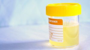 Cloudy Urine Causes 