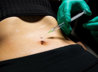 What to Know Belly Button Reconstruction Surgery?