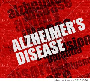  Early Alzheimer's 