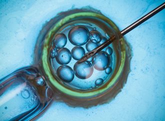 What to know Assisted Reproductive Technology