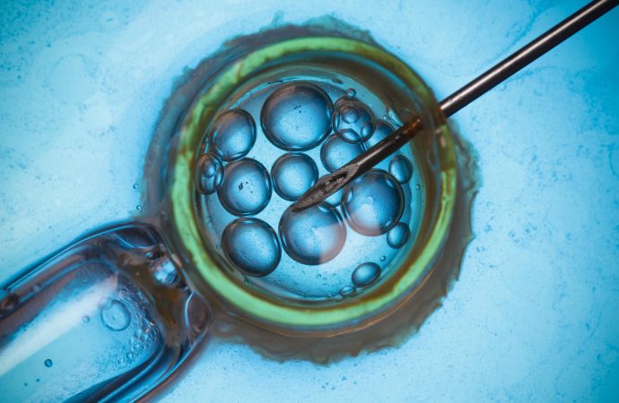 What to know Assisted Reproductive Technology