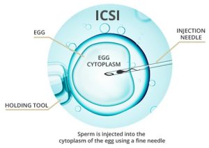 Assisted Reproductive Technology