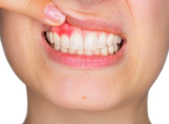 Keeping Teeth Clean: Tips to Beat Plaque and Smile Bright