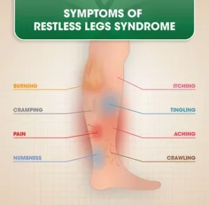 Restless Legs Syndrome