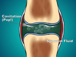 Knee Pain in Cold 