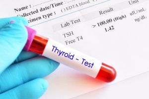 Underactive Thyroid