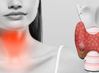 Understanding Underactive Thyroid: Causes, Symptoms, and Treatment